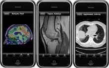 medical images displayed on a mobile phone